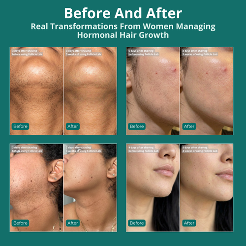 Follicle Control Oil